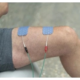 Chattanooga Intelect Mobile 2 Stim