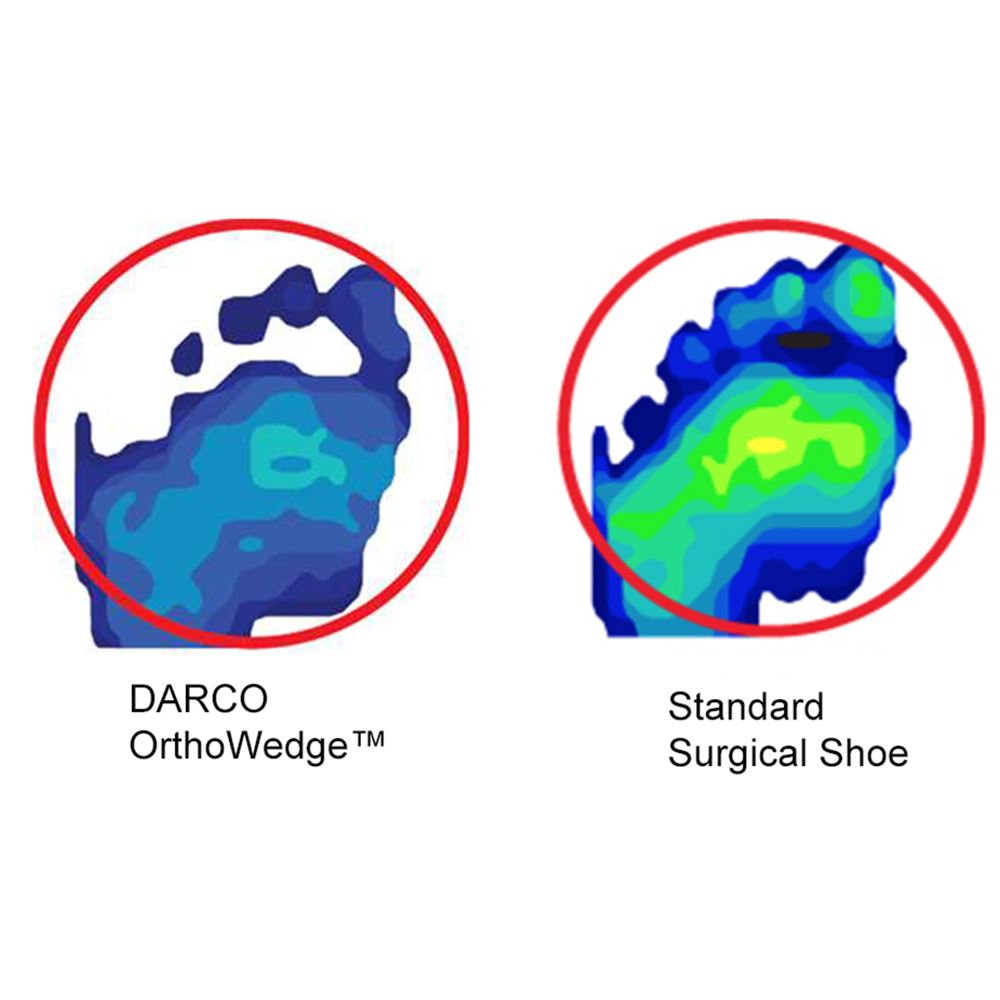 DARCO OrthoWedge™ Shoe Orthowedge Shoe Forefoot Offloading Shoe