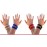 WristWidget Wrist Splint for Ulnar Sided Wrist Pain TFCC Injury