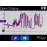 NeuroTrac MYOPLUS PRO EMG