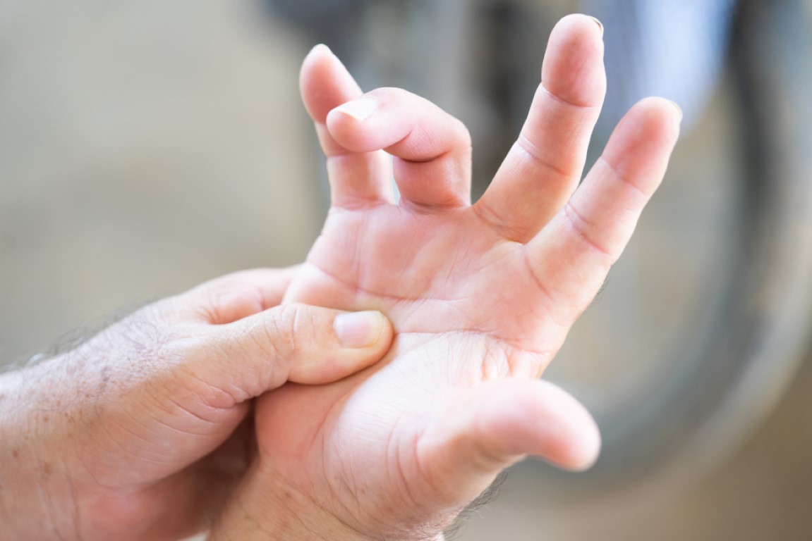 Trigger finger: Causes, treatment, and remedies